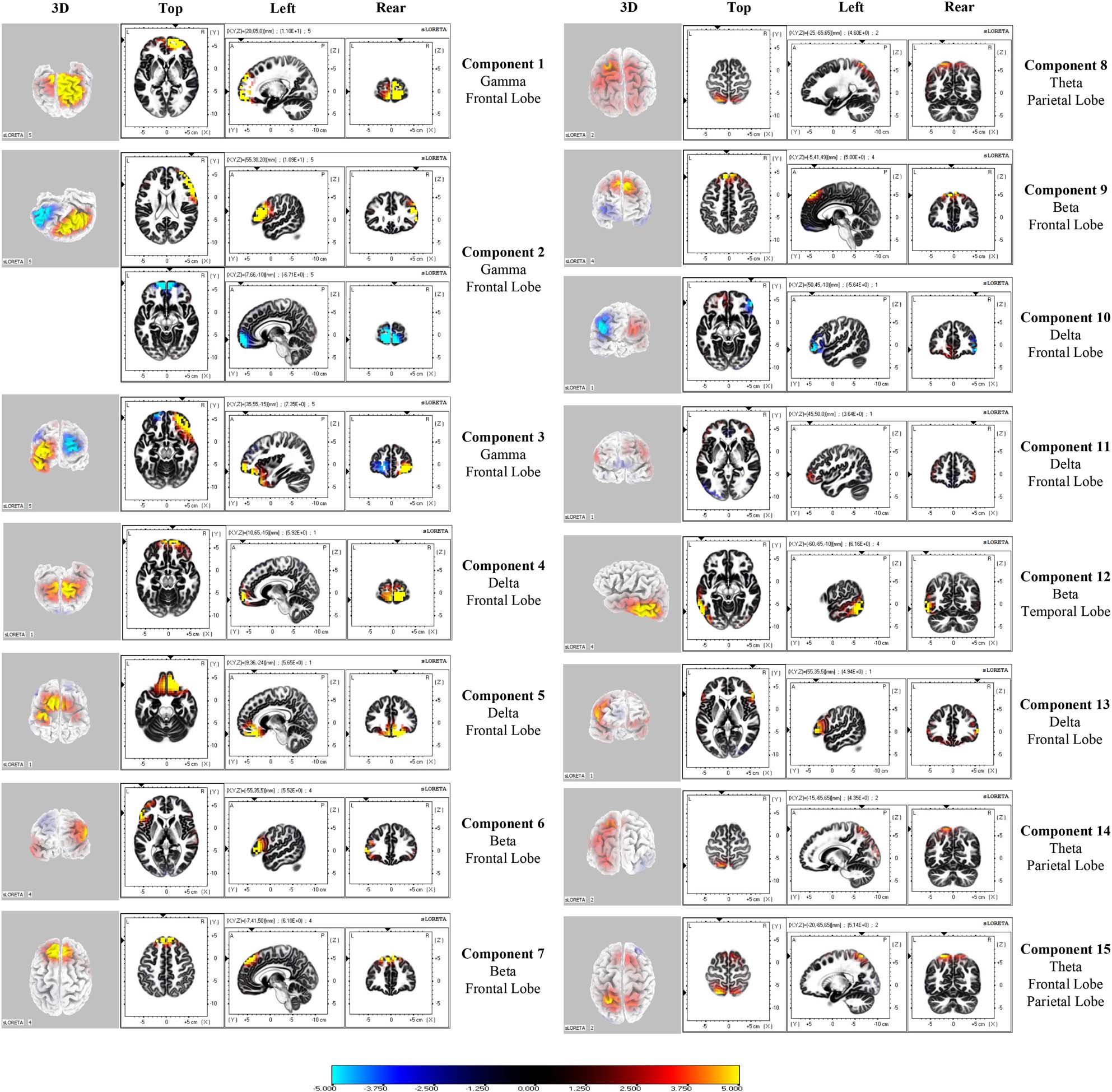 Differential Effects of Specific Emotions on Spatial Decision-Making: Evidence from Cross-Frequency Functionally Independent Brain Networks